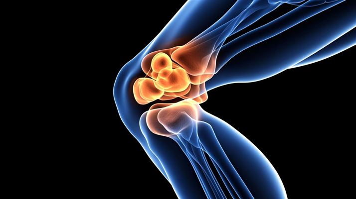 Springer knæ - forstå, behandl og forebyg